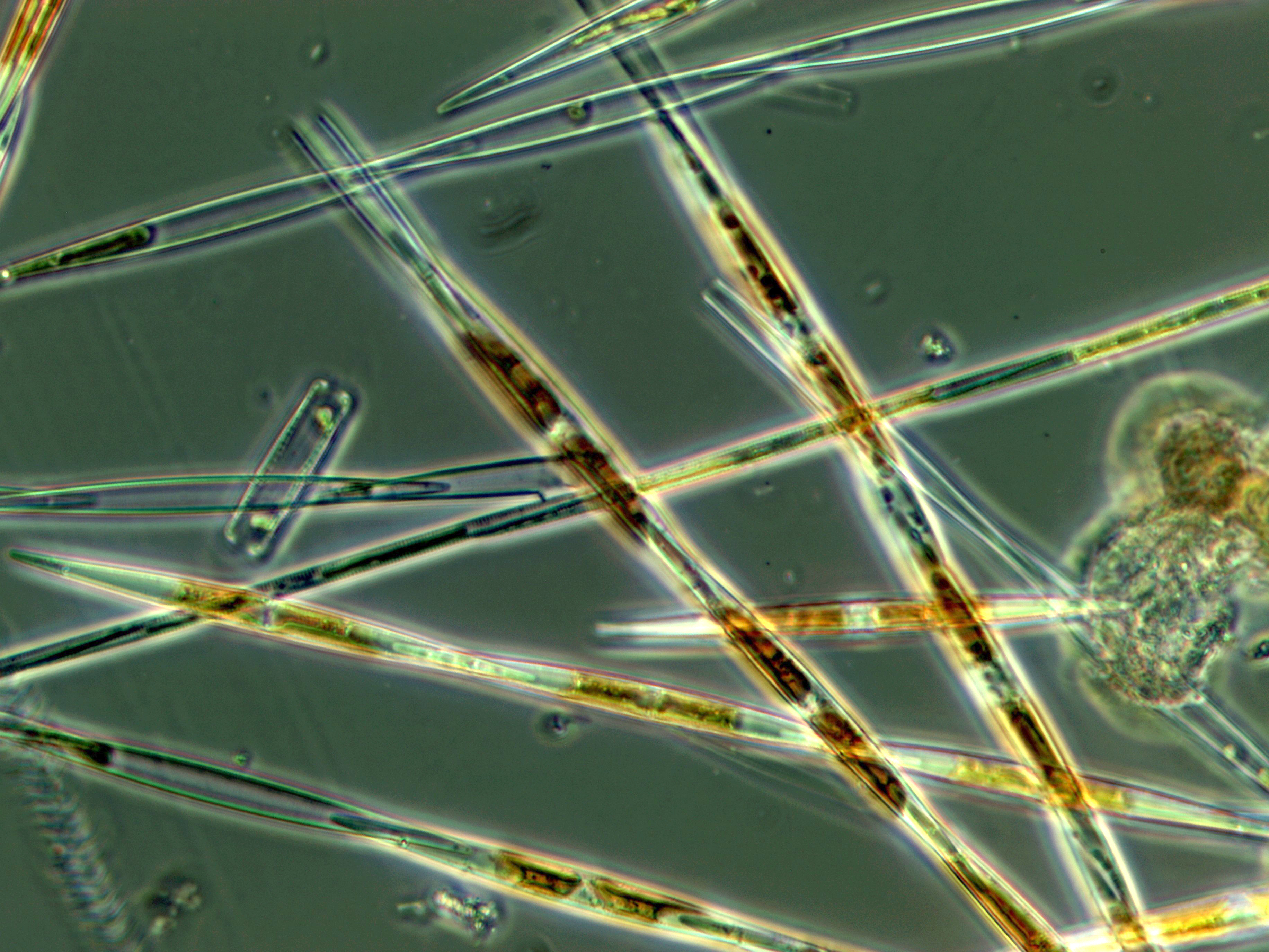 A close-up of Pseudo-nitzchia, a common a common type of phytoplankton