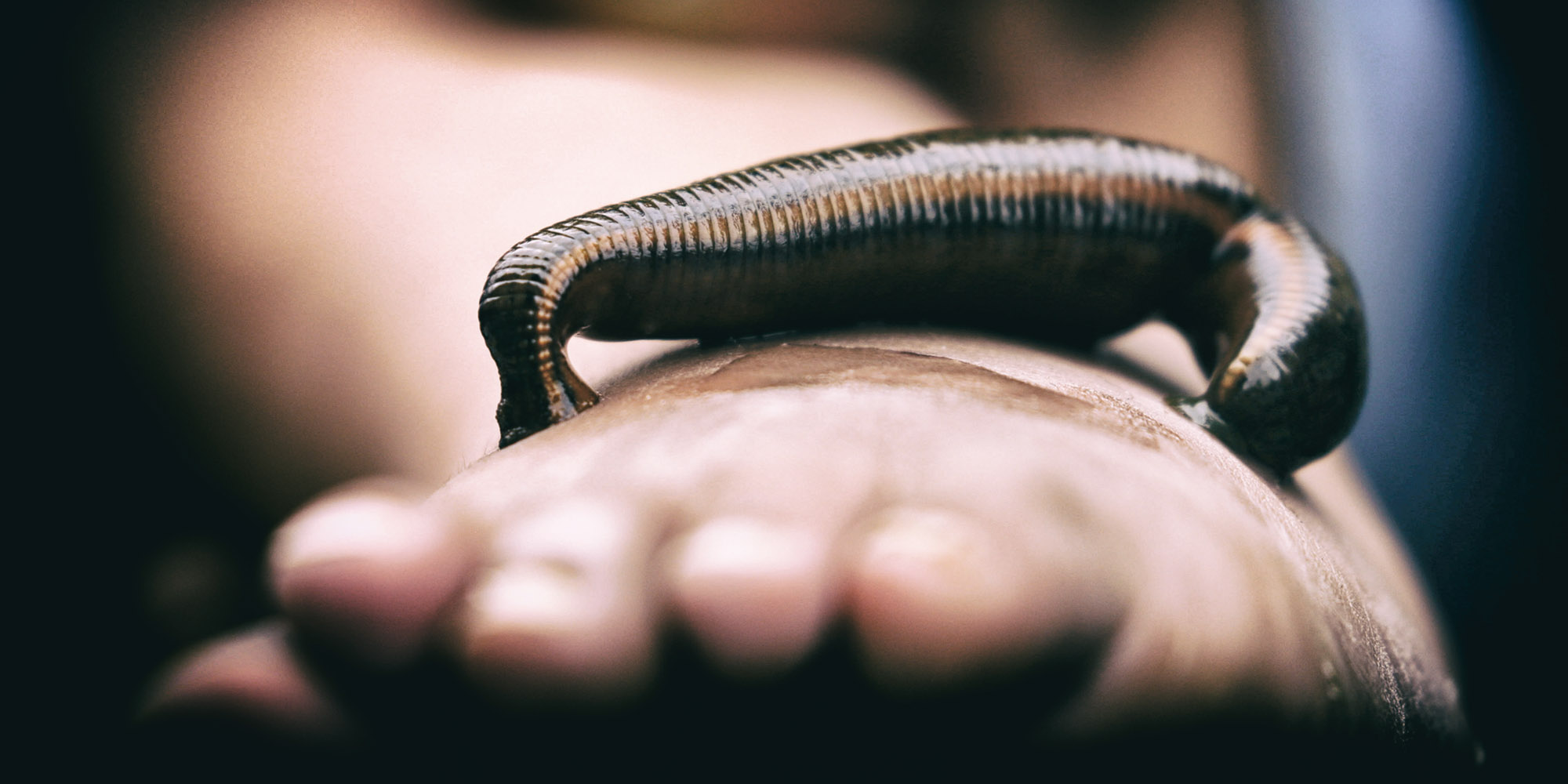 tiara-leeches